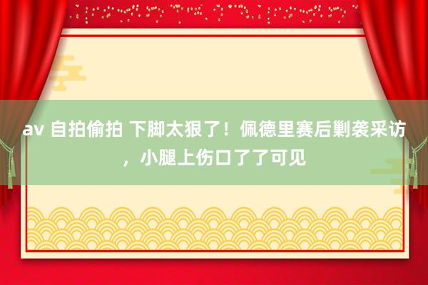 av 自拍偷拍 下脚太狠了！佩德里赛后剿袭采访，小腿上伤口了了可见